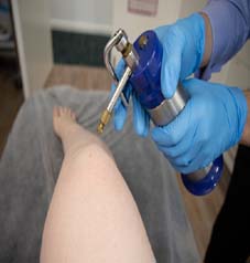 Cryotherapy